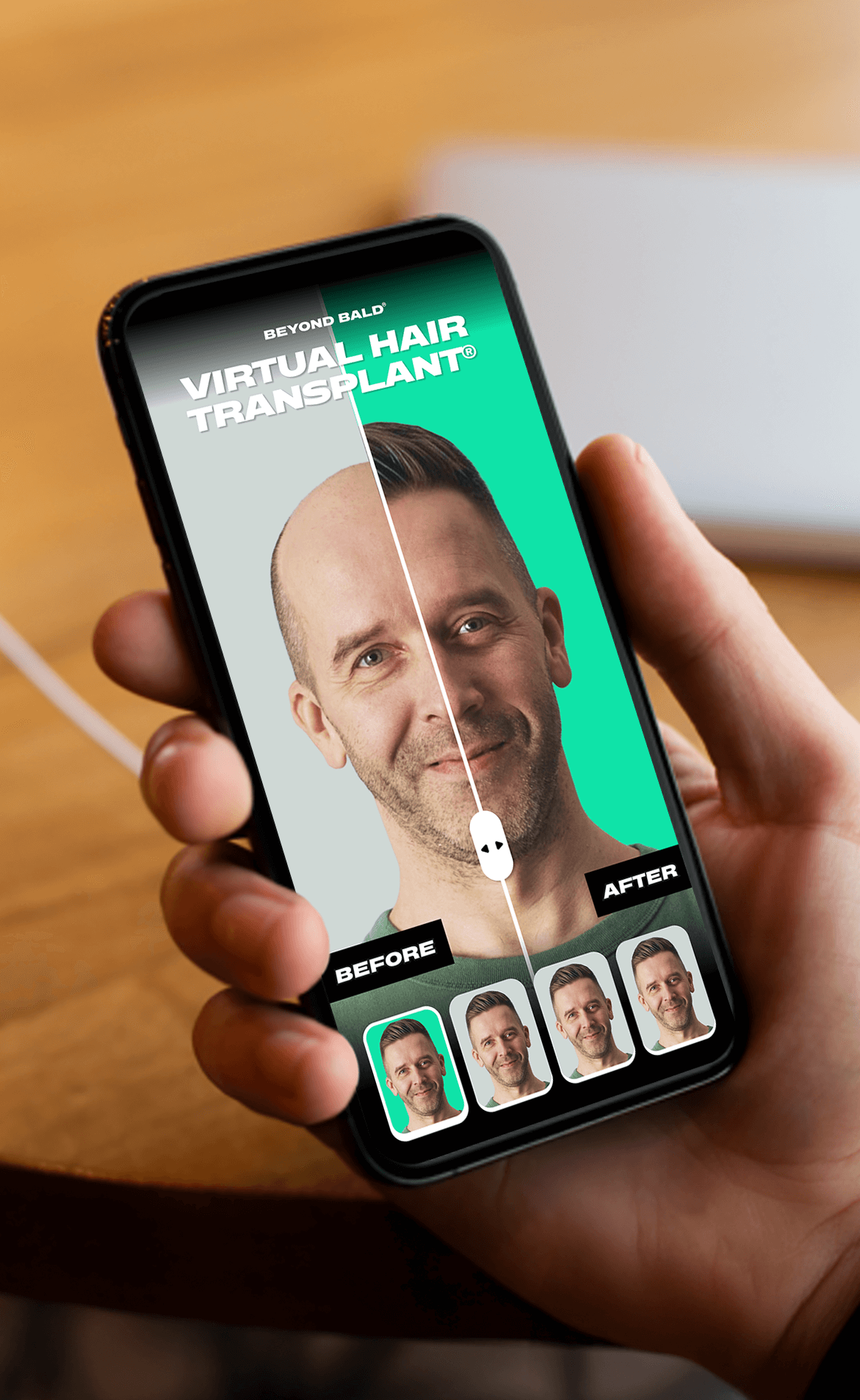 Hair transplant simulator app screenshot